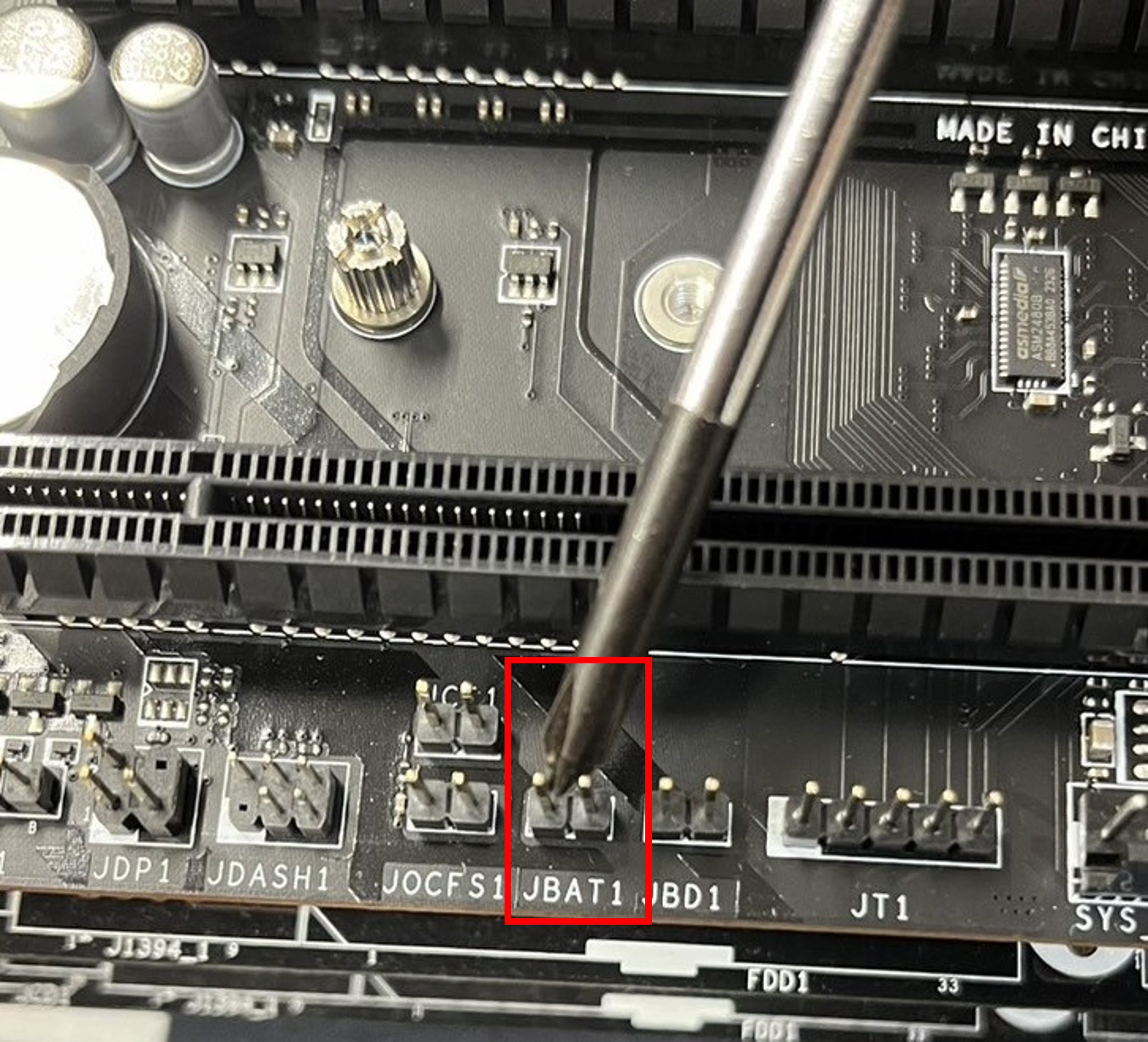 ボタン電池誤飲